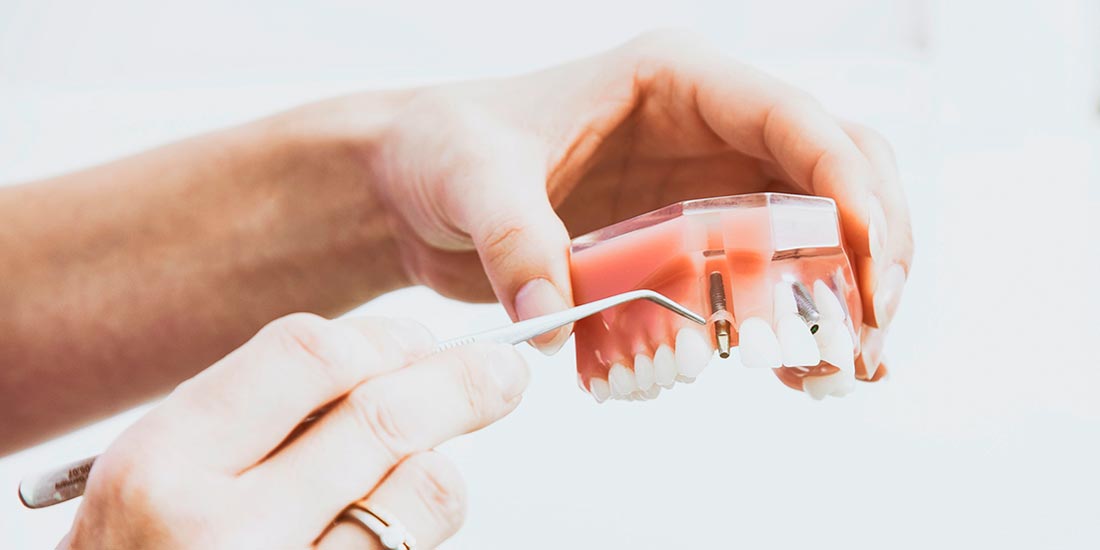 Implantologia dental