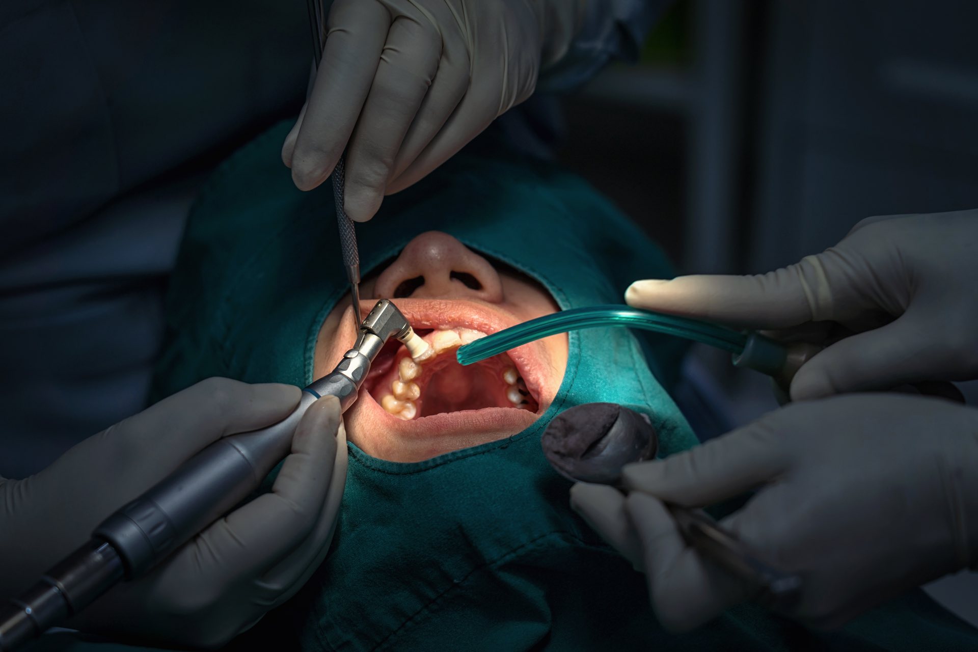 cirurgia periodontal